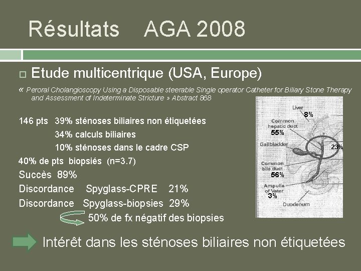 Résultats AGA 2008 Etude multicentrique (USA, Europe) « Peroral Cholangioscopy Using a Disposable steerable