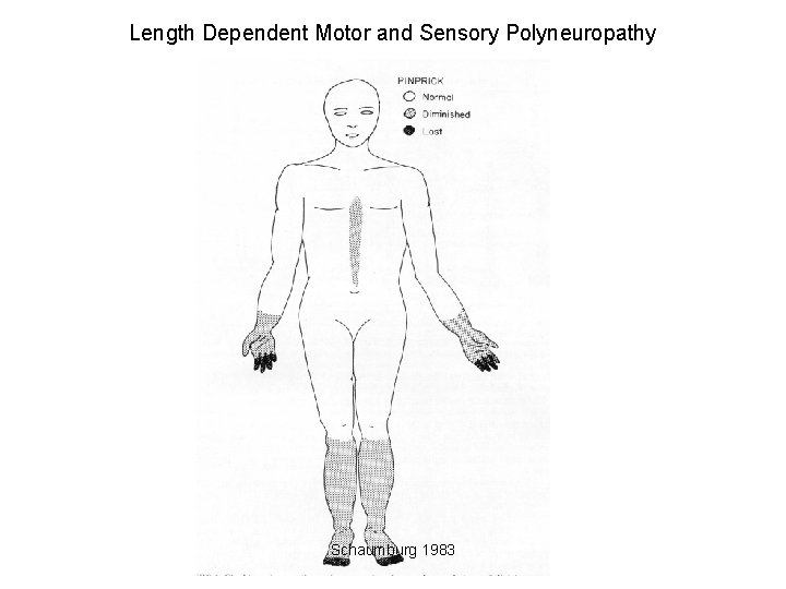 Length Dependent Motor and Sensory Polyneuropathy Schaumburg 1983 