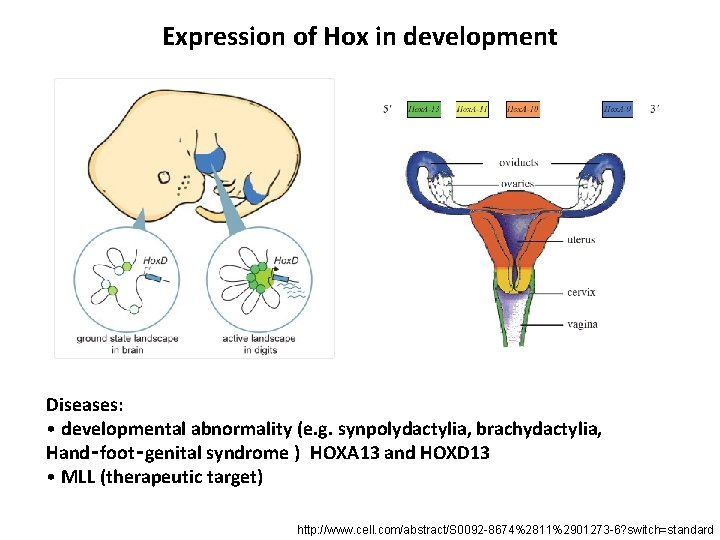 Expression of Hox in development Diseases: • developmental abnormality (e. g. synpolydactylia, brachydactylia, Hand‑foot‑genital