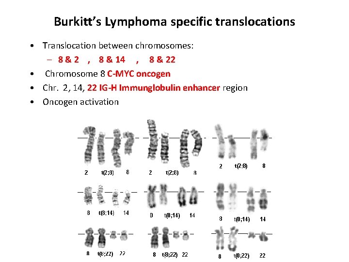 Burkitt’s Lymphoma specific translocations • Translocation between chromosomes: – 8 & 2 , 8