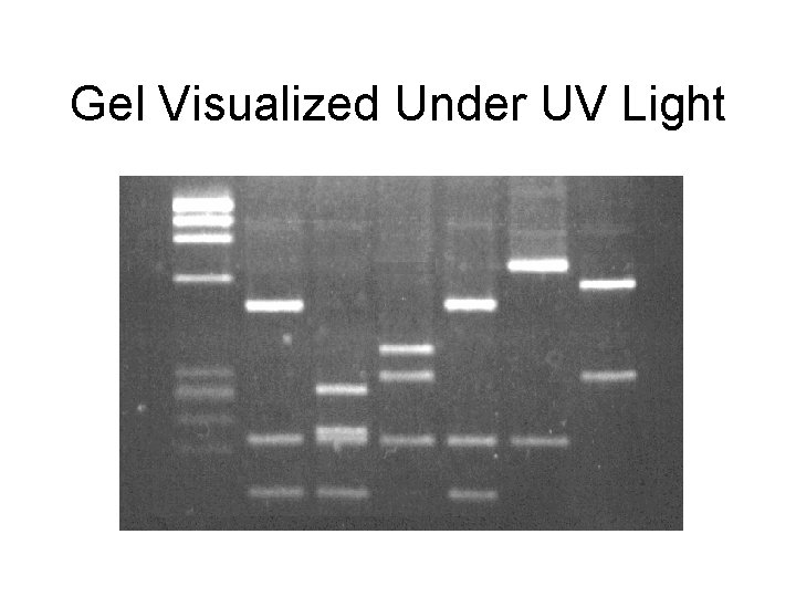 Gel Visualized Under UV Light 