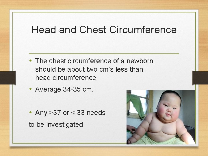 Head and Chest Circumference • The chest circumference of a newborn should be about