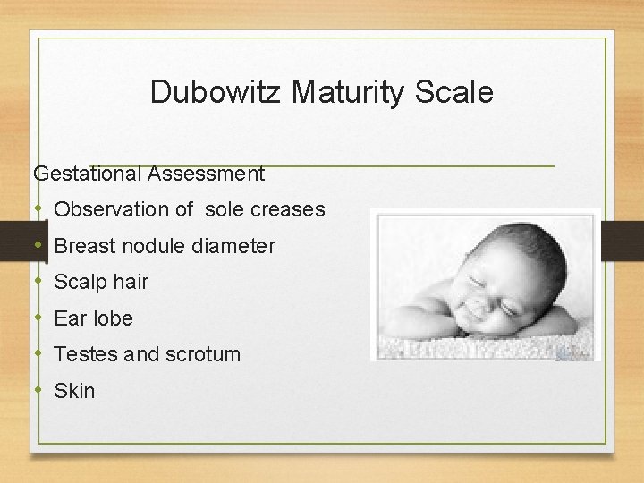 Dubowitz Maturity Scale Gestational Assessment • • • Observation of sole creases Breast nodule