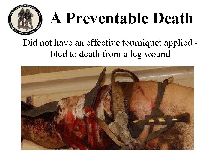 A Preventable Death Did not have an effective tourniquet applied bled to death from
