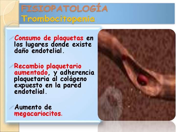  Consumo de plaquetas en los lugares donde existe daño endotelial. Recambio plaquetario aumentado,