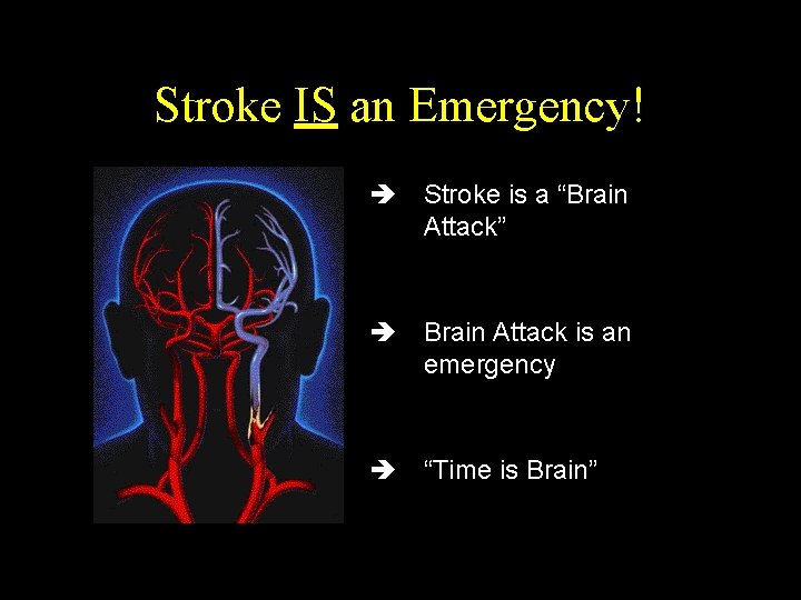 Stroke IS an Emergency! è Stroke is a “Brain Attack” è Brain Attack is