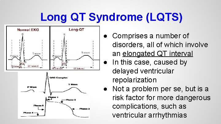 Long QT Syndrome (LQTS) ● Comprises a number of disorders, all of which involve