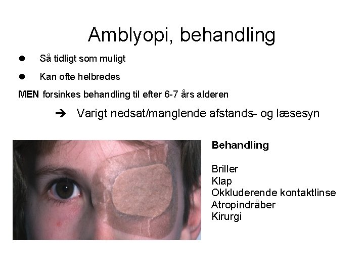 Amblyopi, behandling Så tidligt som muligt Kan ofte helbredes MEN forsinkes behandling til efter