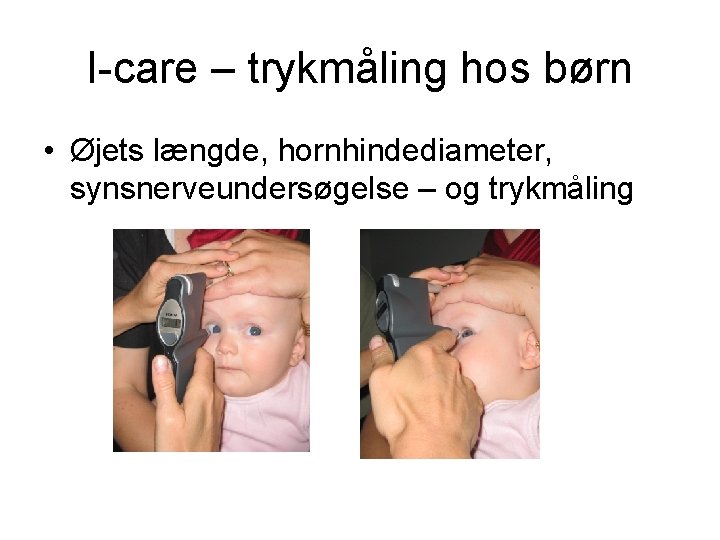 I-care – trykmåling hos børn • Øjets længde, hornhindediameter, synsnerveundersøgelse – og trykmåling 