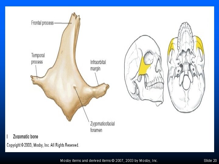 Mosby items and derived items © 2007, 2003 by Mosby, Inc. Slide 20 