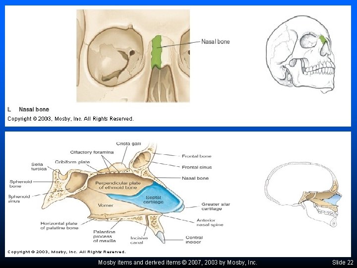 Mosby items and derived items © 2007, 2003 by Mosby, Inc. Slide 22 