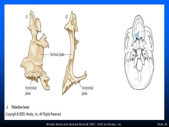 Mosby items and derived items © 2007, 2003 by Mosby, Inc. Slide 26 