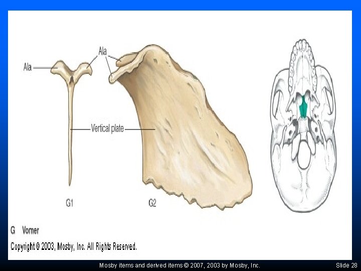 Mosby items and derived items © 2007, 2003 by Mosby, Inc. Slide 28 