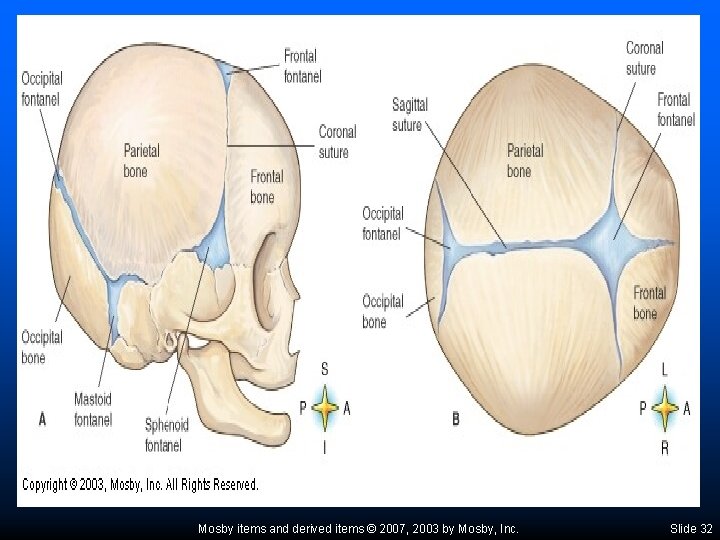 Mosby items and derived items © 2007, 2003 by Mosby, Inc. Slide 32 