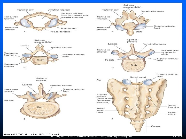 Mosby items and derived items © 2007, 2003 by Mosby, Inc. Slide 40 