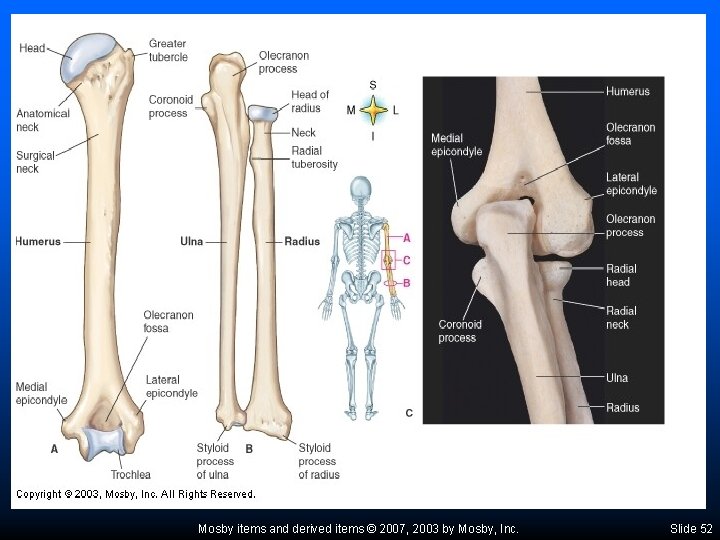 Mosby items and derived items © 2007, 2003 by Mosby, Inc. Slide 52 