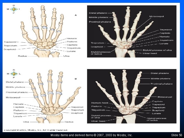 Mosby items and derived items © 2007, 2003 by Mosby, Inc. Slide 56 