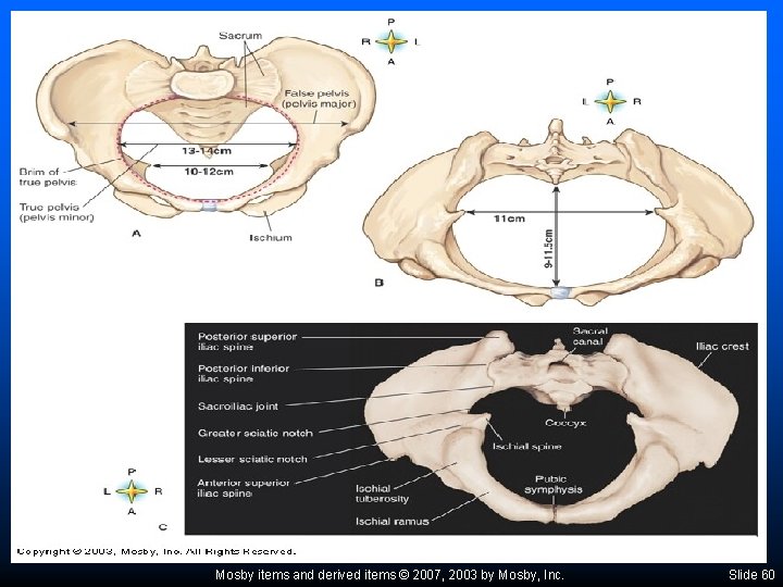 Mosby items and derived items © 2007, 2003 by Mosby, Inc. Slide 60 