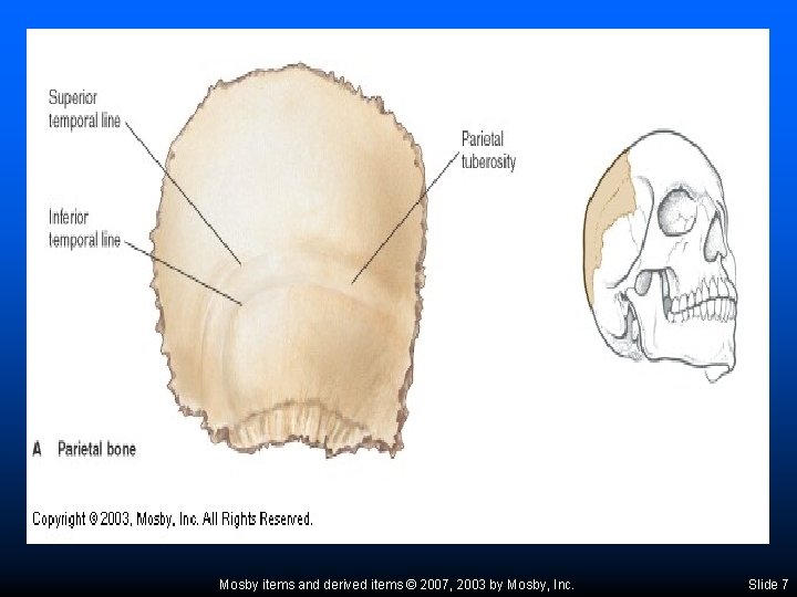 Mosby items and derived items © 2007, 2003 by Mosby, Inc. Slide 7 