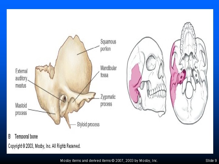 Mosby items and derived items © 2007, 2003 by Mosby, Inc. Slide 9 