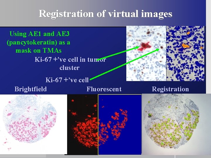 Registration of virtual images Using AE 1 and AE 3 (pancytokeratin) as a mask