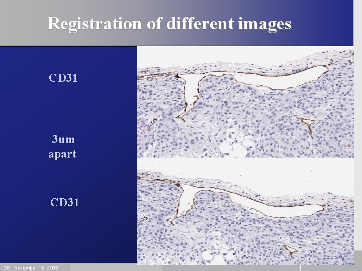 Registration of different images CD 31 3 um apart CD 31 26 November 13,