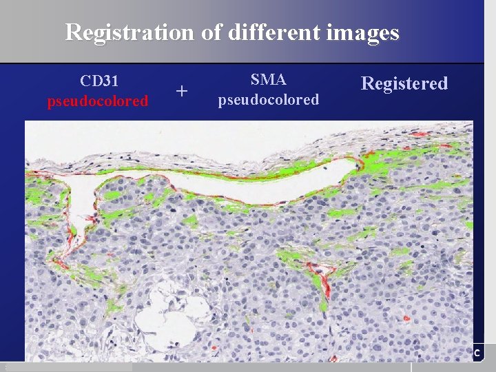 Registration of different images CD 31 pseudocolored 31 November 13, 2003 + SMA pseudocolored