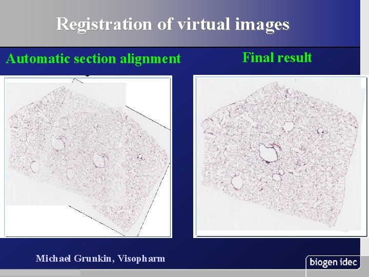 Registration of virtual images Automatic section alignment Michael Grunkin, Visopharm 32 November 13, 2003