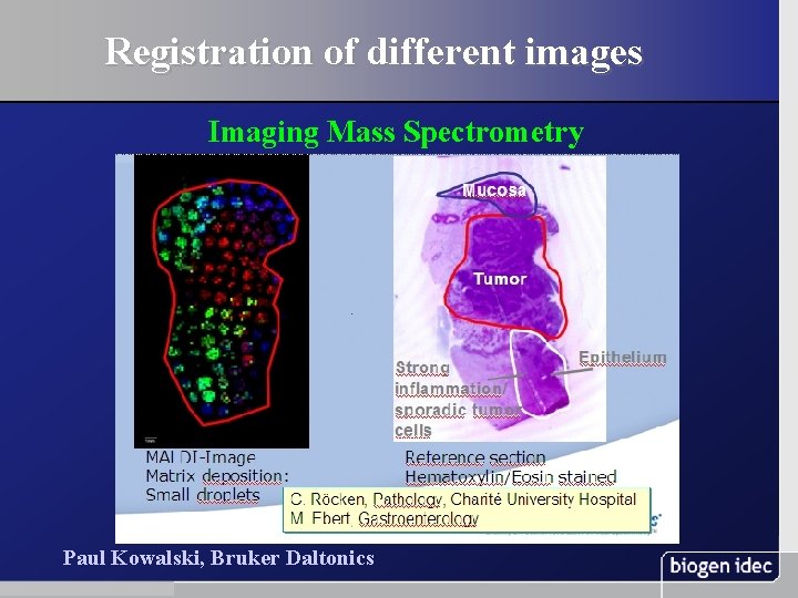 Registration of different images Imaging Mass Spectrometry Paul Kowalski, Bruker Daltonics 35 November 13,