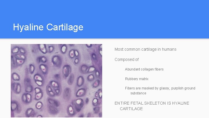 Hyaline Cartilage Most common cartilage in humans Composed of Abundant collagen fibers Rubbery matrix