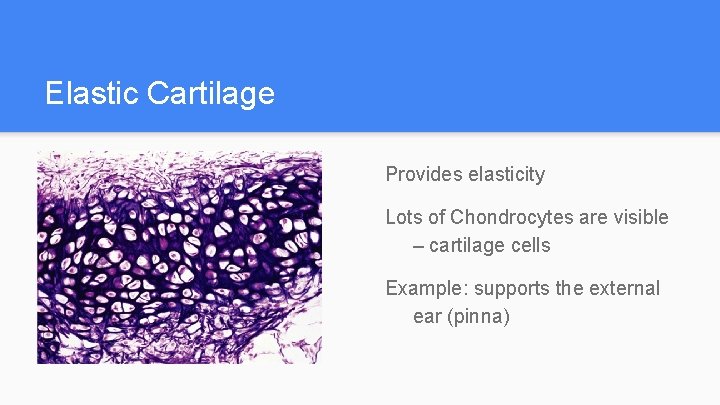 Elastic Cartilage Provides elasticity Lots of Chondrocytes are visible – cartilage cells Example: supports