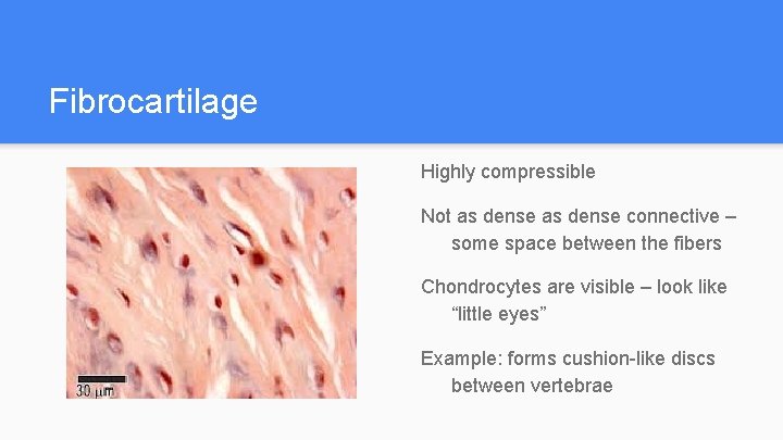 Fibrocartilage Highly compressible Not as dense connective – some space between the fibers Chondrocytes