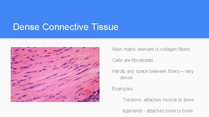 Dense Connective Tissue Main matrix element is collagen fibers Cells are fibroblasts Hardly any