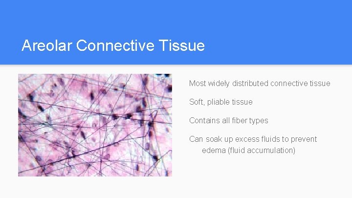 Areolar Connective Tissue Most widely distributed connective tissue Soft, pliable tissue Contains all fiber