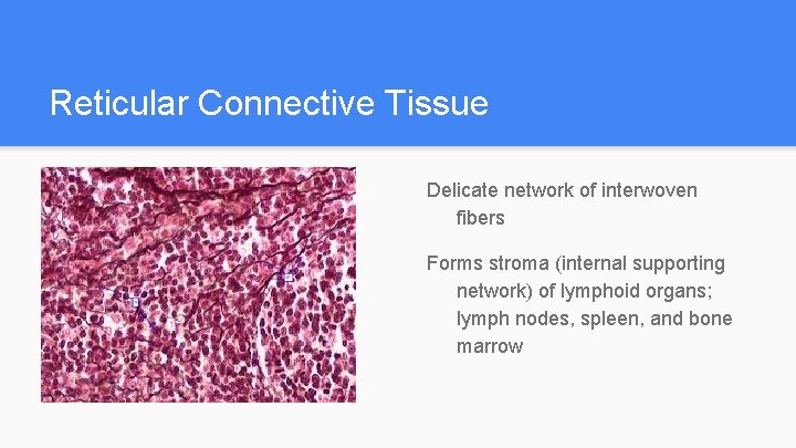 Reticular Connective Tissue Delicate network of interwoven fibers Forms stroma (internal supporting network) of