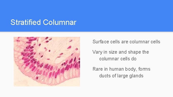 Stratified Columnar Surface cells are columnar cells Vary in size and shape the columnar