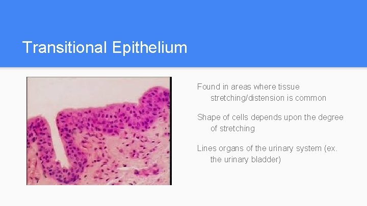 Transitional Epithelium Found in areas where tissue stretching/distension is common Shape of cells depends