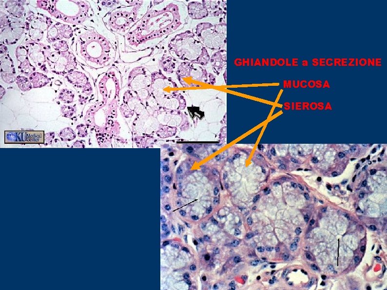GHIANDOLE a SECREZIONE MUCOSA SIEROSA 