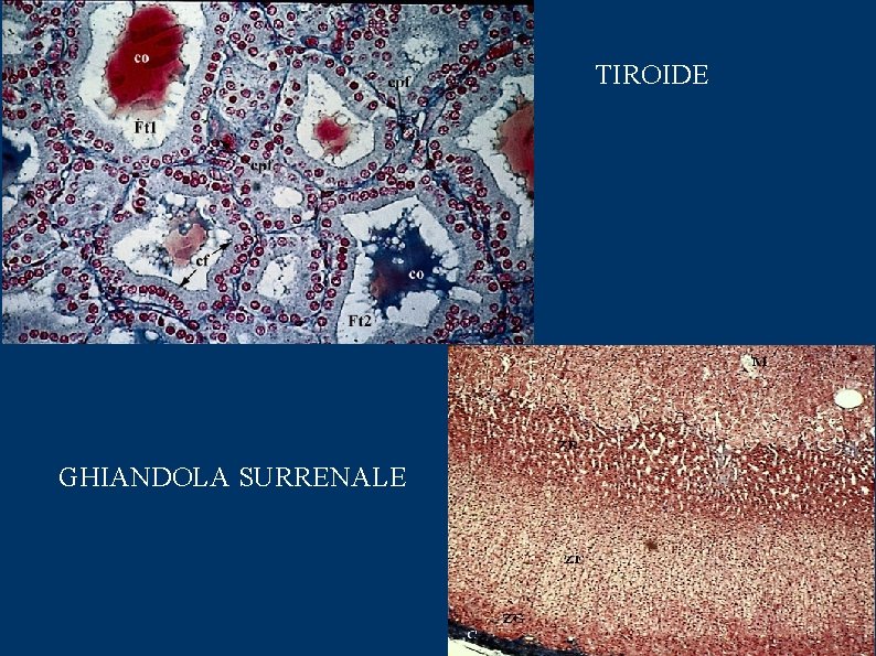 TIROIDE GHIANDOLA SURRENALE 