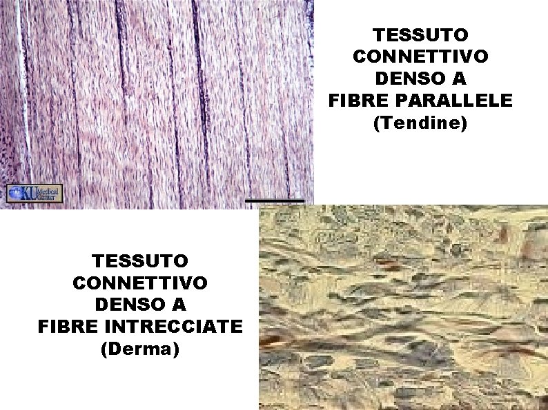 TESSUTO CONNETTIVO DENSO A FIBRE PARALLELE (Tendine) TESSUTO CONNETTIVO DENSO A FIBRE INTRECCIATE (Derma)