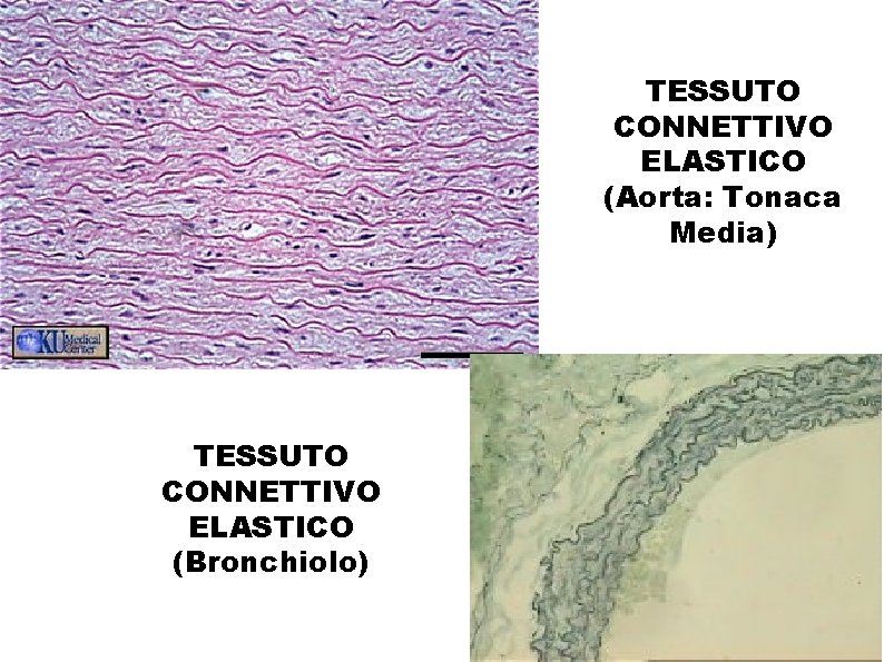 TESSUTO CONNETTIVO ELASTICO (Aorta: Tonaca Media) TESSUTO CONNETTIVO ELASTICO (Bronchiolo) 