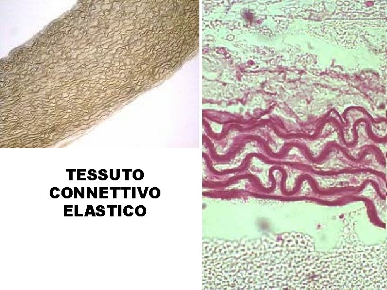 TESSUTO CONNETTIVO ELASTICO 