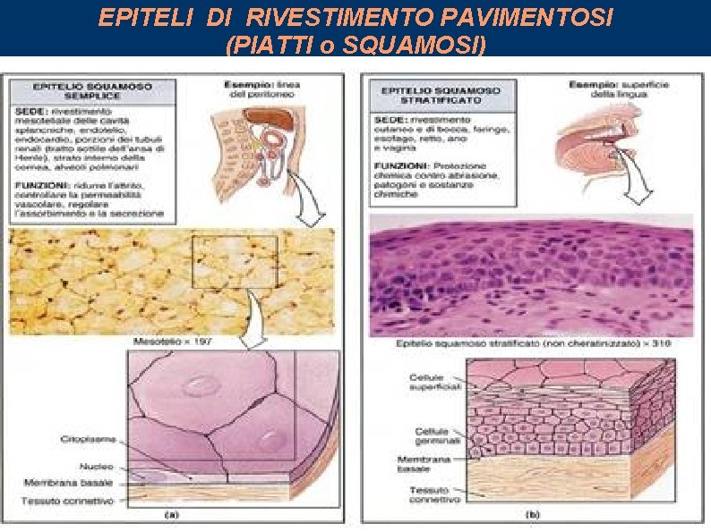 EPITELI DI RIVESTIMENTO PAVIMENTOSI (PIATTI o SQUAMOSI) 