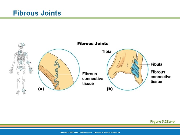 Fibrous Joints Figure 5. 28 a–b Copyright © 2009 Pearson Education, Inc. , publishing