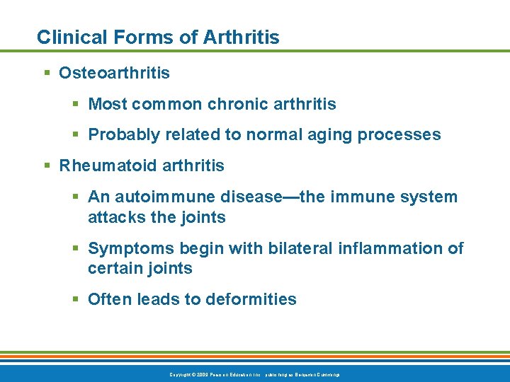 Clinical Forms of Arthritis Osteoarthritis Most common chronic arthritis Probably related to normal aging
