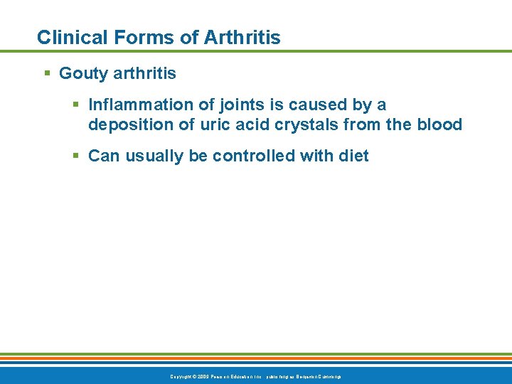 Clinical Forms of Arthritis Gouty arthritis Inflammation of joints is caused by a deposition