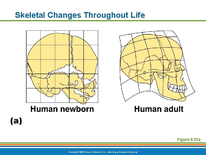 Skeletal Changes Throughout Life Figure 5. 33 a Copyright © 2009 Pearson Education, Inc.