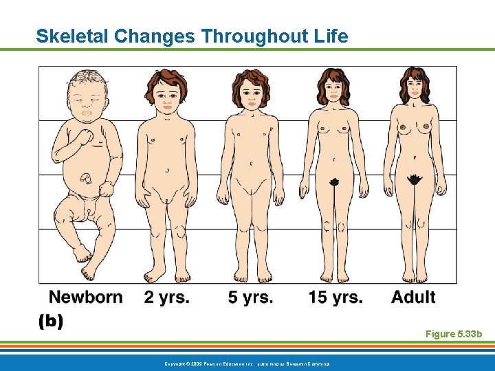 Skeletal Changes Throughout Life Figure 5. 33 b Copyright © 2009 Pearson Education, Inc.