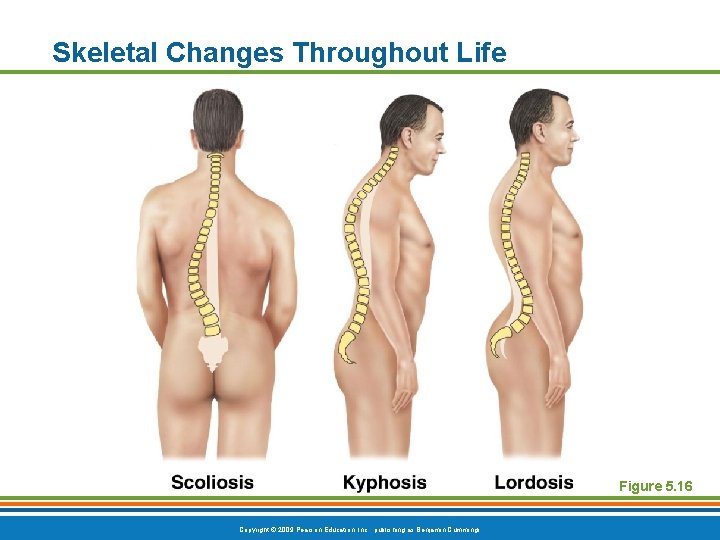 Skeletal Changes Throughout Life Figure 5. 16 Copyright © 2009 Pearson Education, Inc. ,