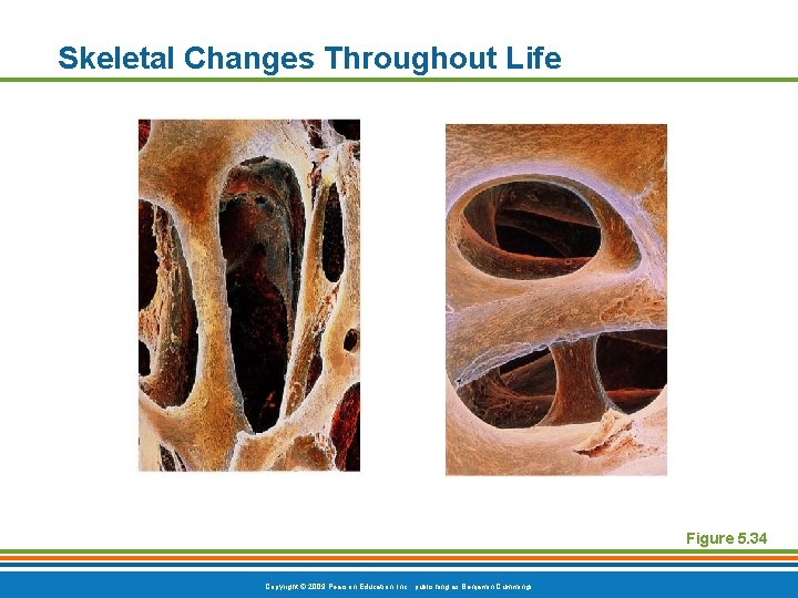 Skeletal Changes Throughout Life Figure 5. 34 Copyright © 2009 Pearson Education, Inc. ,